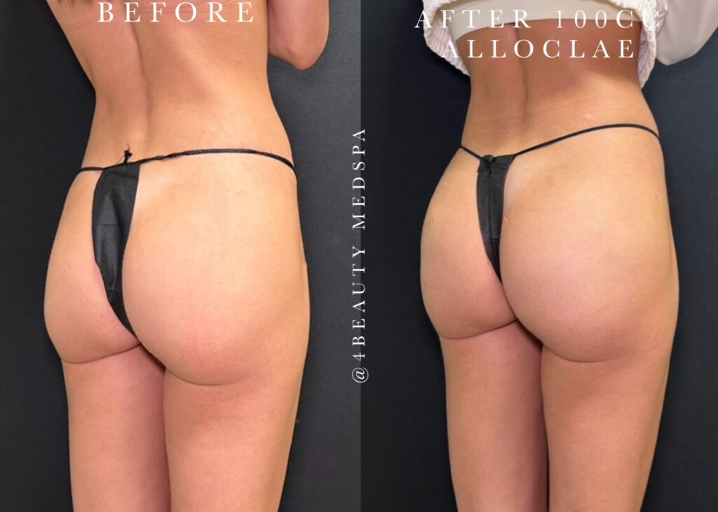 Before and after results 3