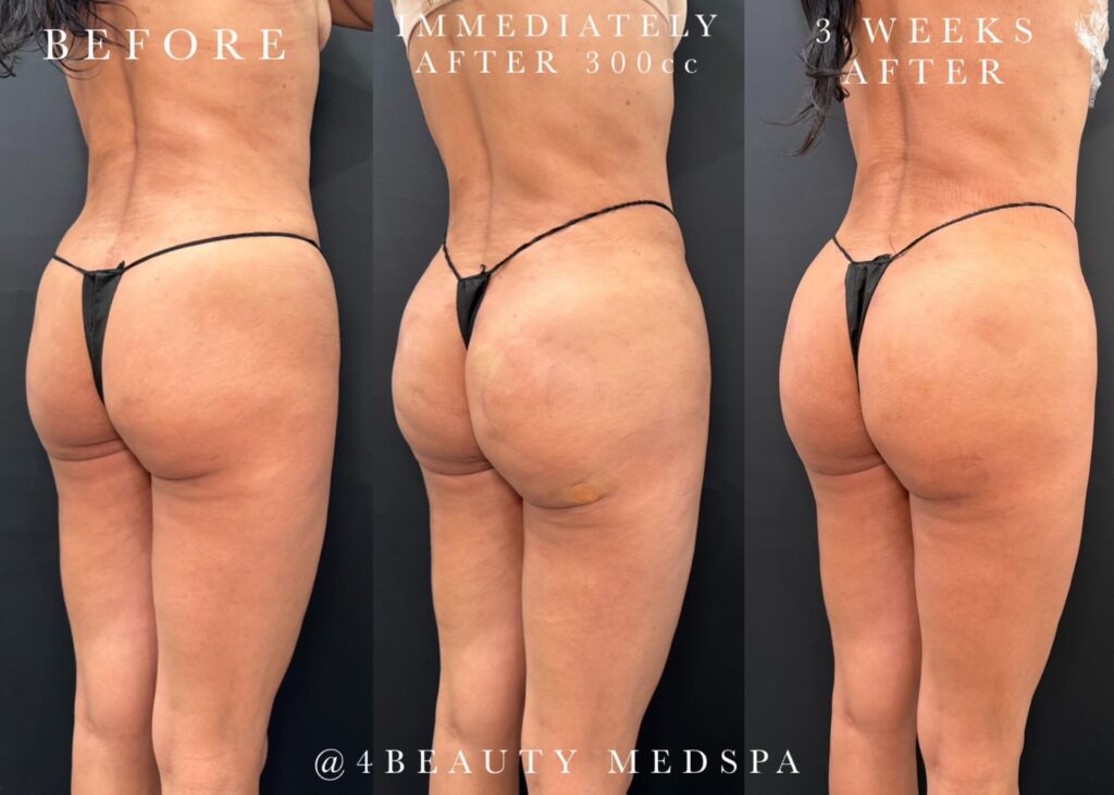 Before and after results 2