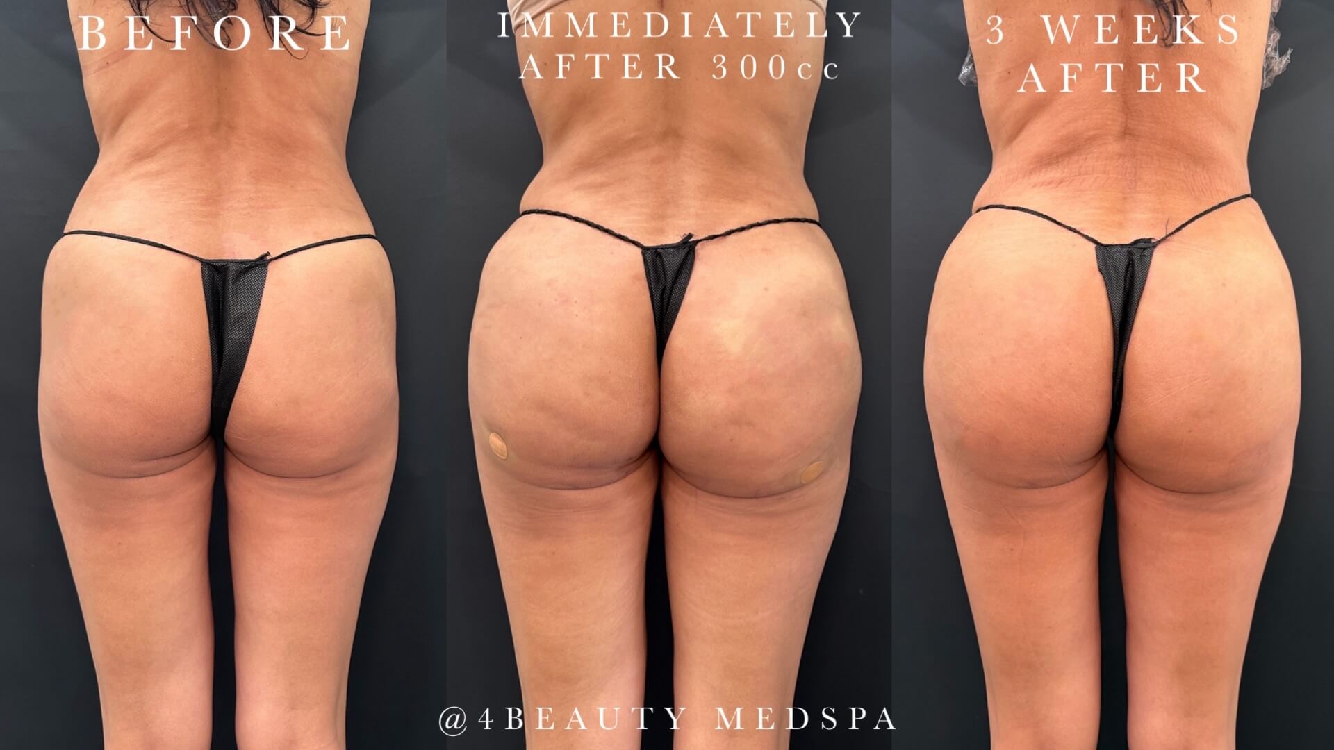 Woman in a sparkle dress