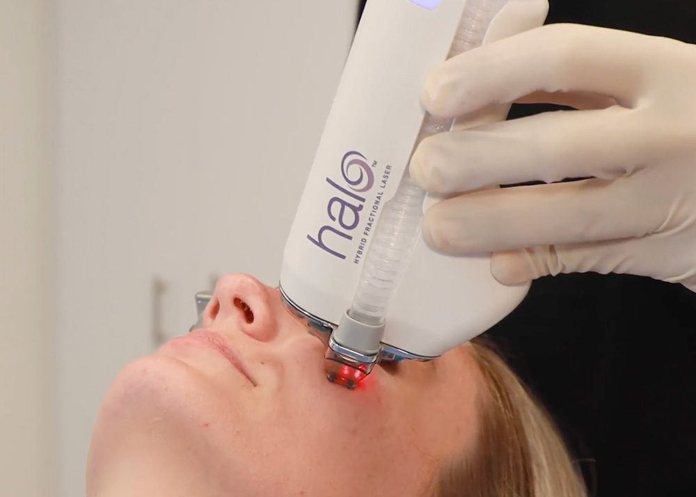 Halo device being used