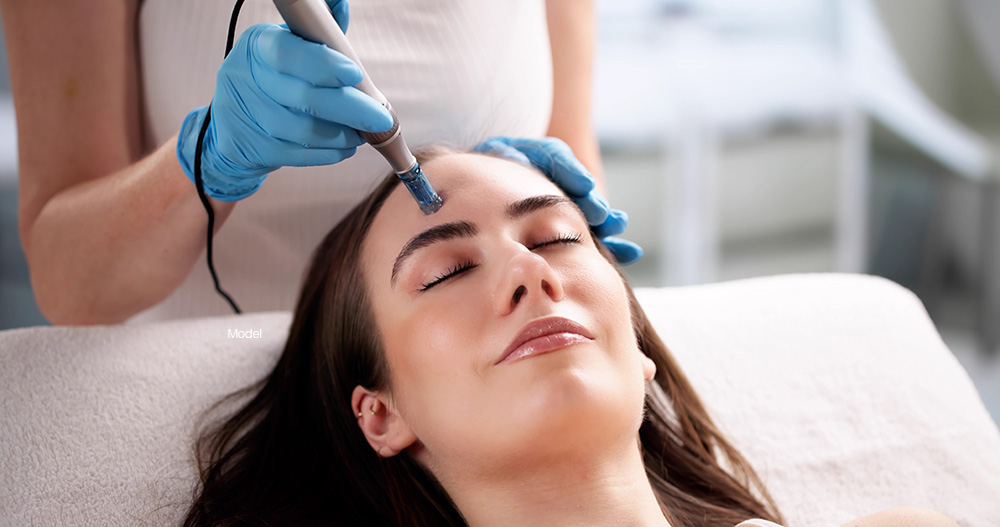 Woman getting microneedling on her forehead